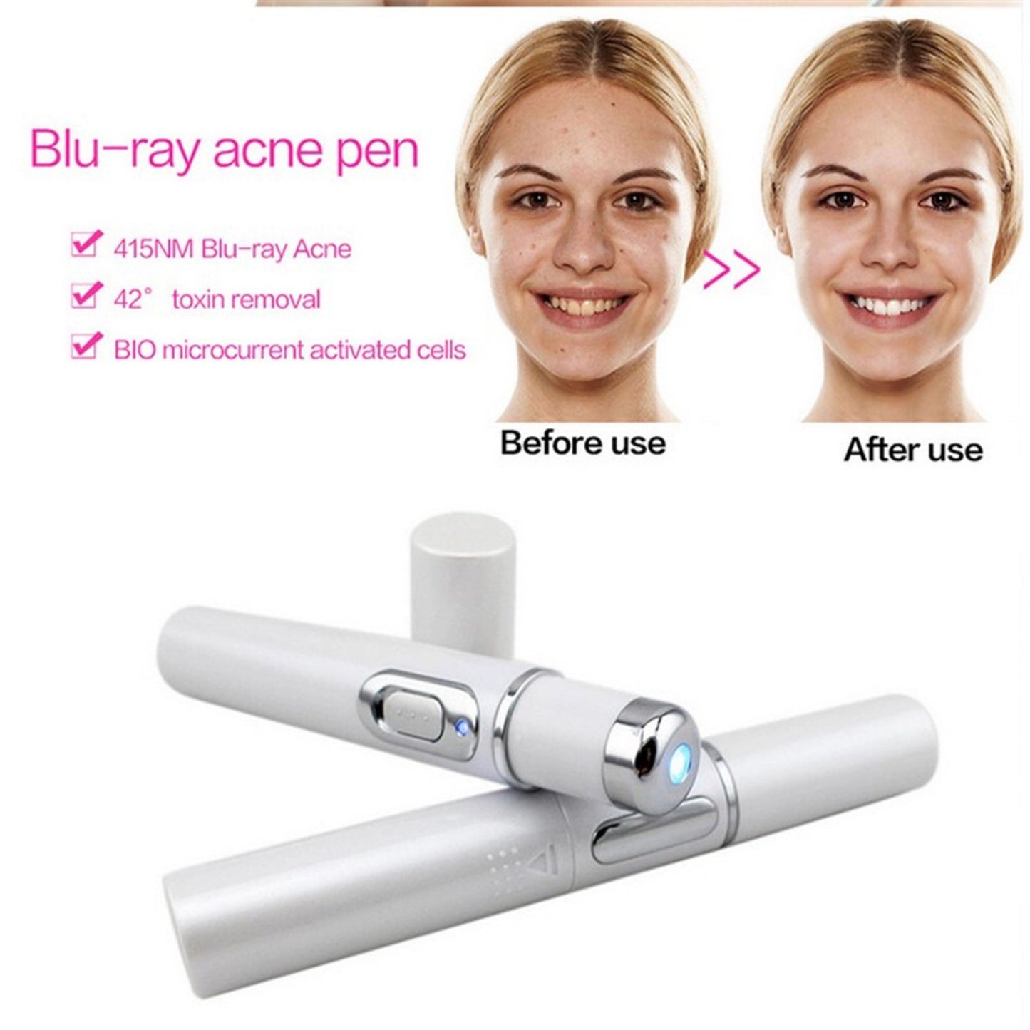 Blue Light Acne Pen